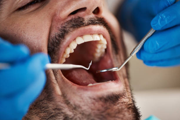 Best Emergency Root Canal Treatment in Holly Hill, SC
